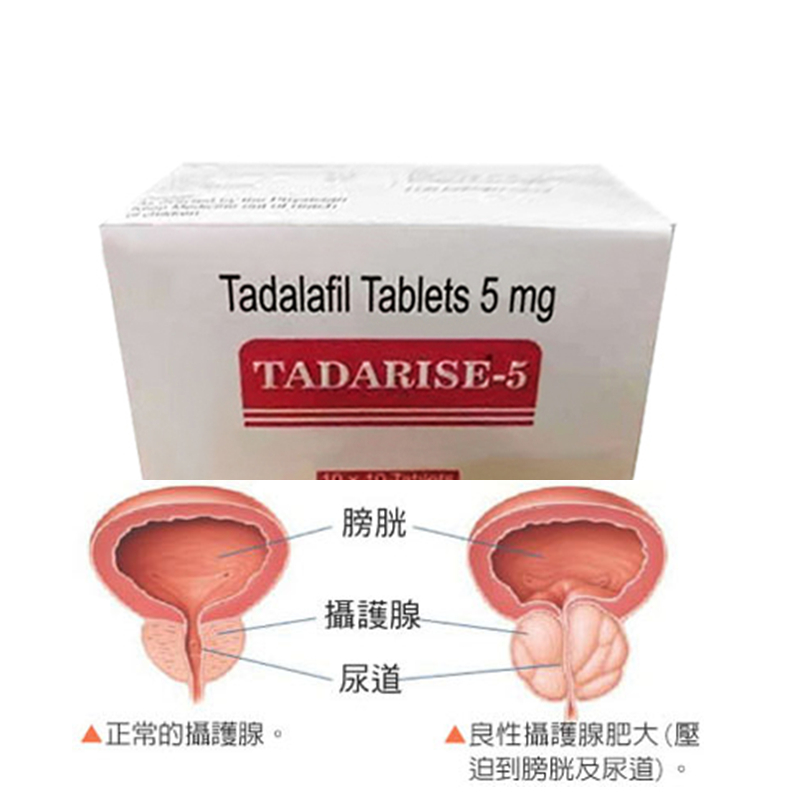 Tadalafil 5mg是什麼？功效、作用與適用人群完整解析